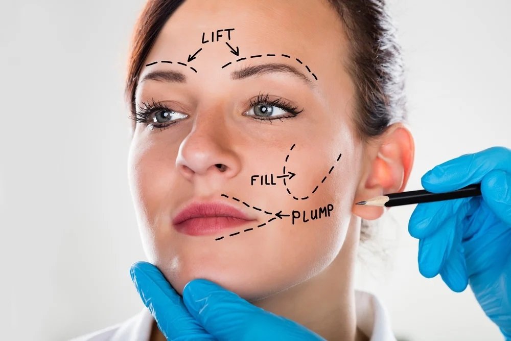 From Consultation to Recovery: A Step-by-Step Guide to Facelift Surgery